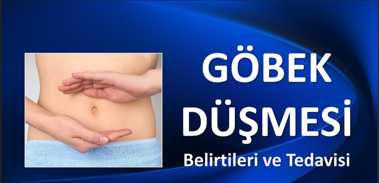 Göbek düşüklüğü belirtileri ve tedavisi bilgilendirmesi